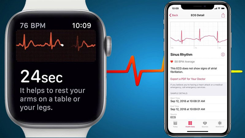 Apple Watch đưa ra những cảnh báo sức khỏe chưa chính xác 