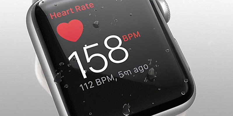 Apple Watch đã đưa ra những cảnh báo nhầm 