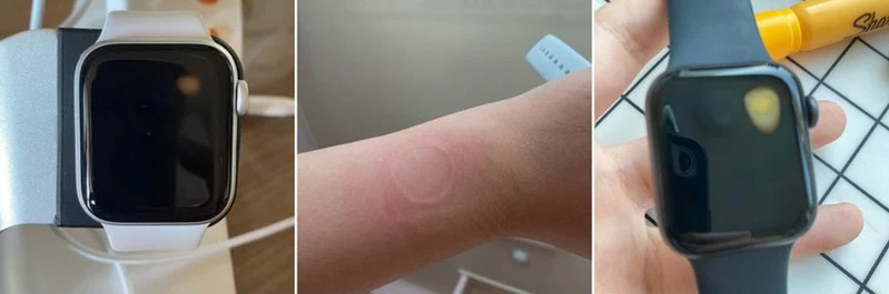 apple watch se gặp lỗi quá nhiệt hình 3 Apple watch SE gặp lỗi quá nhiệt