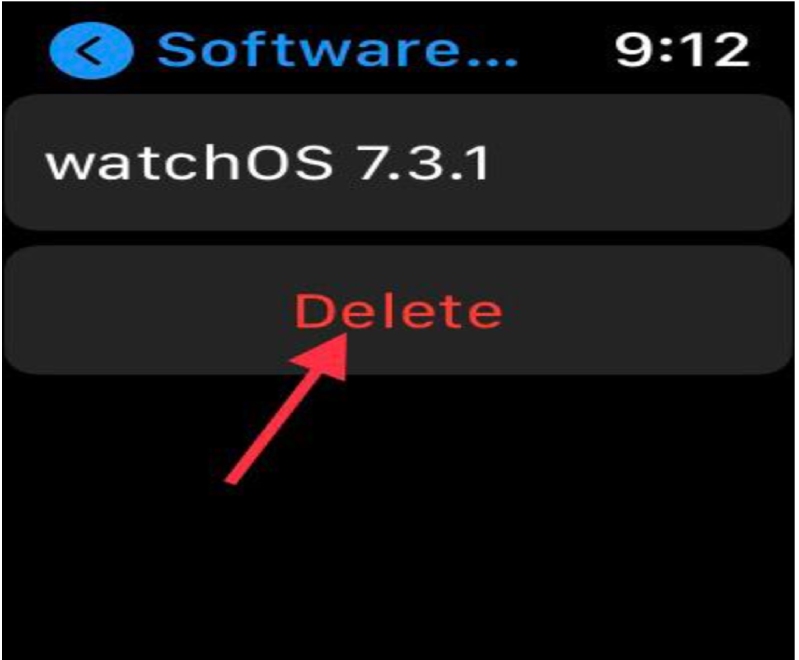 nhấn vào xoá trên apple watch
